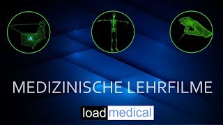 Schizophrenie  einfach und verständlich erklärt [upl. by Kcorb]