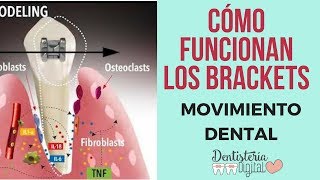 CÓMO FUNCIONAN LOS BRACKETS  Movimiento Dental [upl. by Aihseyk504]