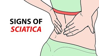 Signs of Sciatica [upl. by Sakul608]