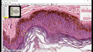 Keratinized stratified squamous epithelium [upl. by Poole304]