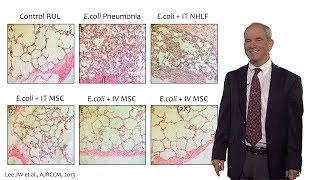 Challenges with implementing mesenchymal stem cells into practice [upl. by Richard]