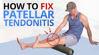 5 Exercises to Fix quotPatellar Tracking Disorderquot [upl. by Inalial21]