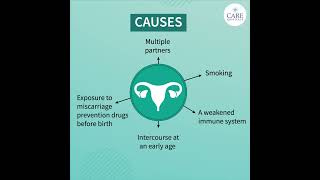 Detecting Early Signs of Cervical Cancer [upl. by Akinehs55]