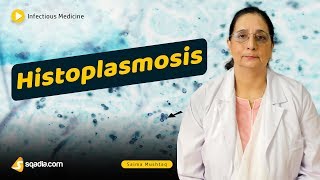 Histoplasmosis  Infectious Diseases Medicine Lecture  Medical School Student  VLearning [upl. by Nyvrem]